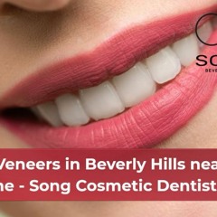 Veneers In Beverly Hills Near Me - Song Cosmetic Dentistry