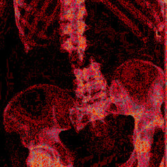 broken spine