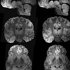 Say So ft Kidd Jersey