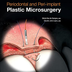 [VIEW] EPUB 📁 Periodontal and Peri-implant Plastic Microsurgery: Minimally Invasive