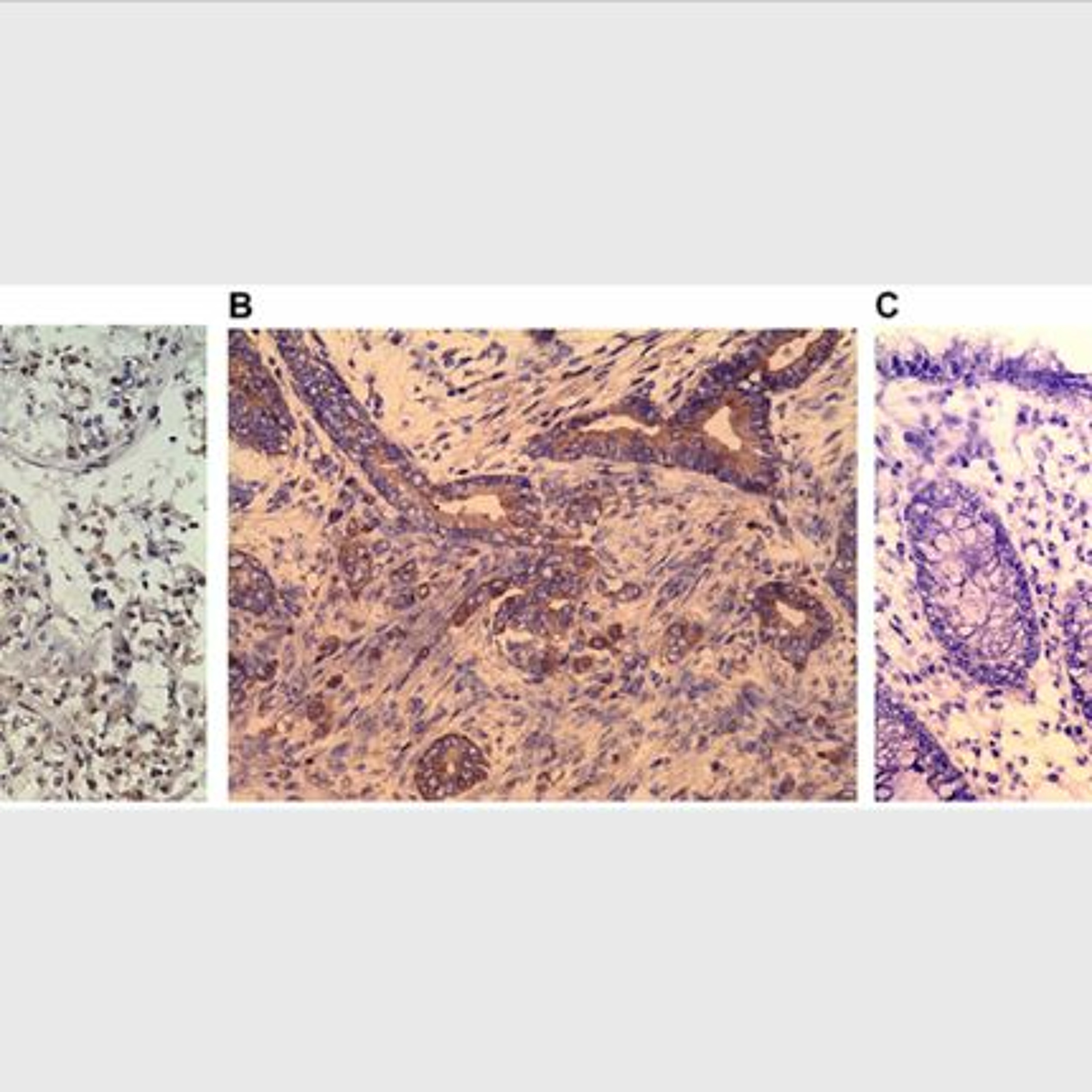 Oncotarget