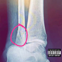 Worldwide Gary "100 A Pop" (Ankle tape)