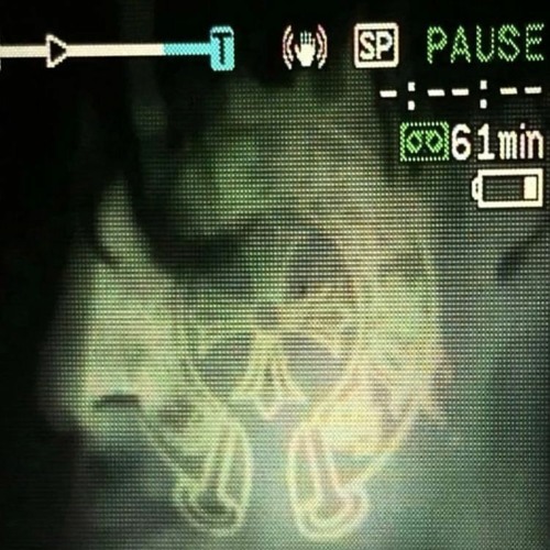 brentsrevenge - is wat it is (thr6x + mental) [slump audios exclusive]