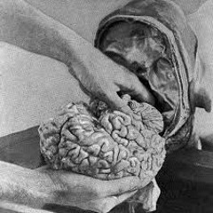 Brainøize - Intrusion Neuronale
