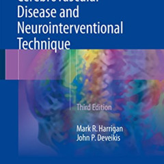 [Download] KINDLE 💛 Handbook of Cerebrovascular Disease and Neurointerventional Tech