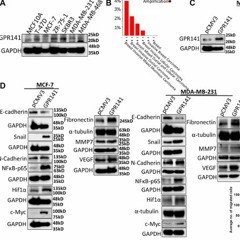 GPR141 Regulates Breast Cancer Progression via Oncogenic Mediators and the p-mTOR/p53 Axis