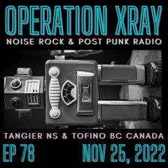 OPERATION XRAY EP 78 - Nov 25, 2022
