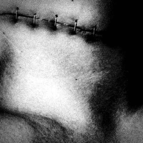 Scar / (тгк: ugshooter)