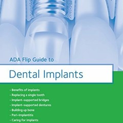 Open PDF ADA Flip Guide to Dental Implants (ADA Flip Guides) by  American Dental Association