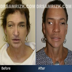 blood in my lungs prod zatru