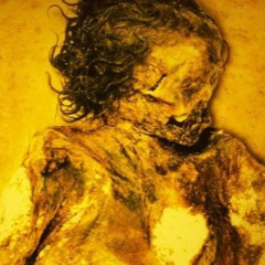 Hyperemesis - Massive Gas Embolism
