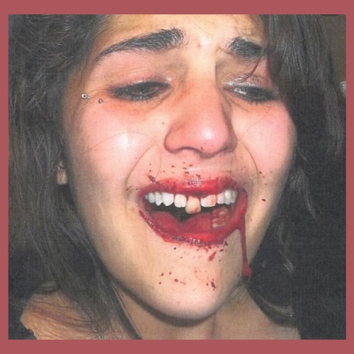 Call The Fking Police [freedl]