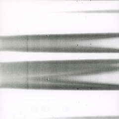 the timeline of healing