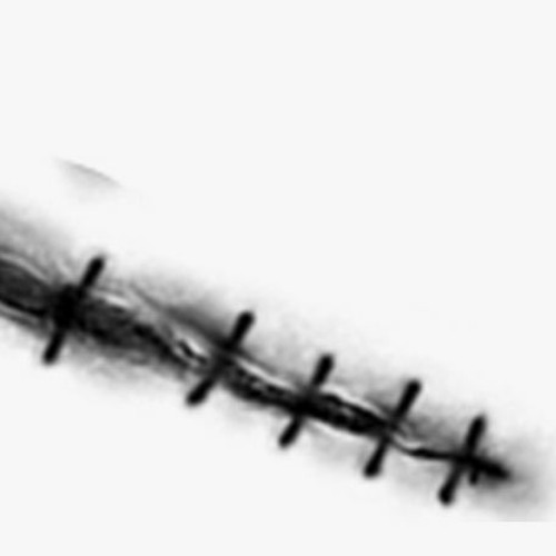 Stream Stitch Up Life by Suine Listen online for free on SoundCloud