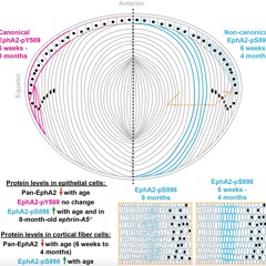 EphA2 Signaling in Eye Lens Aging: Wild-Type, Knockout, and Aging Mice