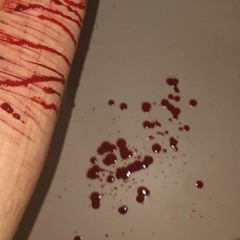 Семьсот Семь - Травми =)