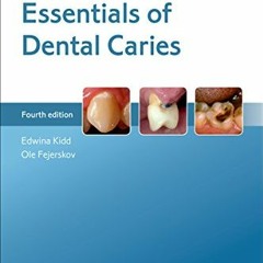 [View] EBOOK EPUB KINDLE PDF Essentials of Dental Caries by  Edwina Kidd &  Ole Fejer