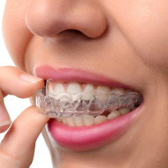 Invisalign Care: Tips for Keeping Your Aligners Clean and Comfortable