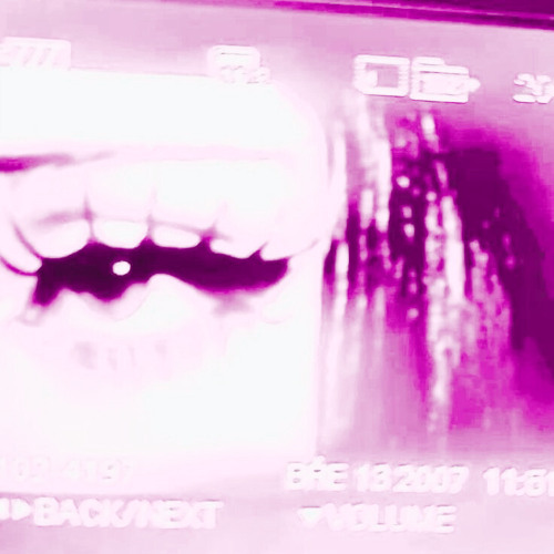 U?