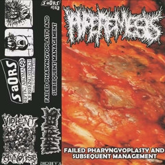 Hyperemesis - Failed Pharyngoplasty and Subsequent Management (FULL ALBUM) 2011