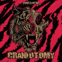 Craniotomy EP