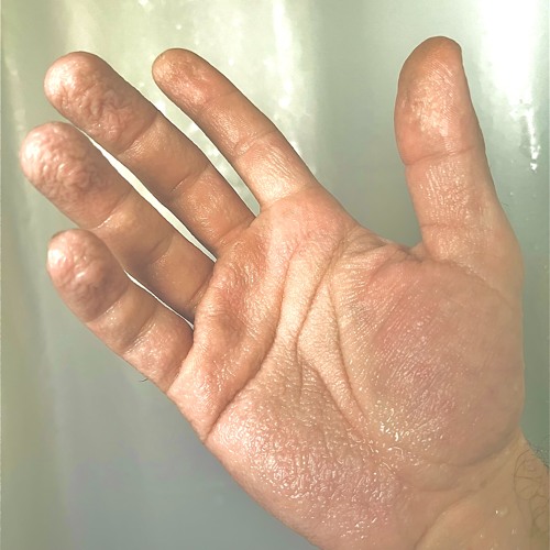 Lagi