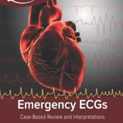 [Get] KINDLE 🖋️ Emergency ECGs: Case-Based Review and Interpretations by  Amal Mattu