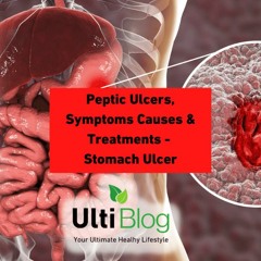 Peptic Ulcer Disease Diet Ultiblog