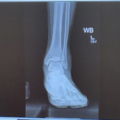 BROKEN ANKLE FREESTYLE (Prod.by YTG)