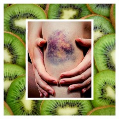 Zari Complex - Hematoma