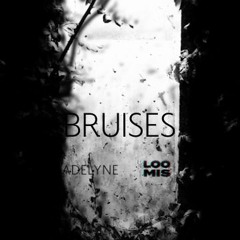 Lewis Capaldi - Bruises [Adelyne & LOOMIS]