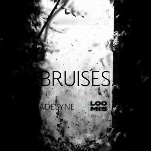 Lewis Capaldi - Bruises [Adelyne & LOOMIS]