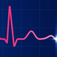 Tachycardia and arrhythmia beats