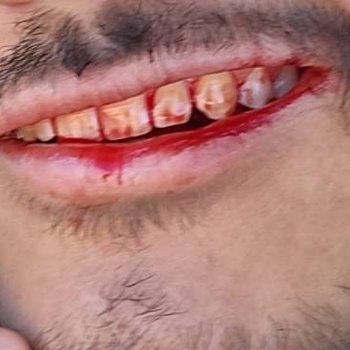 lit up (Official Audio)