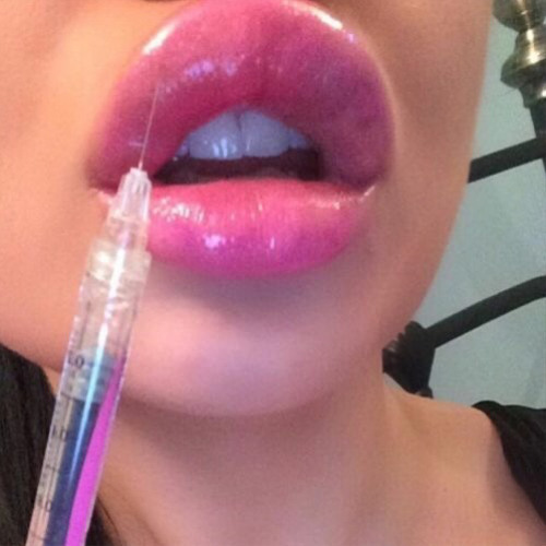 lip bomb ✰✰✰