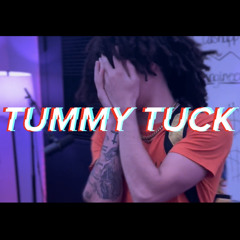 TB Duke - Tummy Tuck
