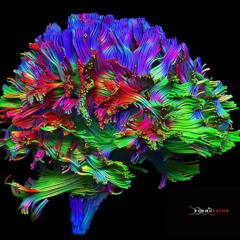 Cortical Drift