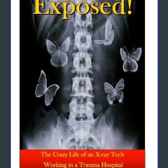 Read ebook [PDF] 📖 Exposed!: The Crazy Life of an X-ray Tech Working in a Trauma Hospital Read Boo