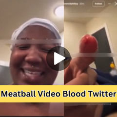 Full: Meatball Video On Twitter Finger Blood
