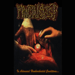 PROCTOLOGIST - Advanced Hemhorroidal Conditions