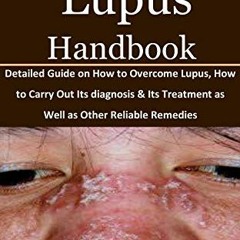 Access EPUB KINDLE PDF EBOOK Overcoming Lupus Handbook: Detailed Guide on How to Overcome Lupus, How