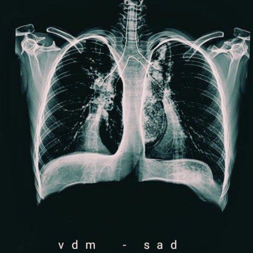 vdm - sad