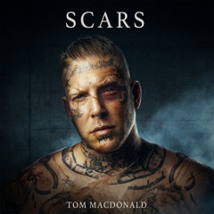 Scars