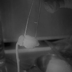 Extraction Of The Spine