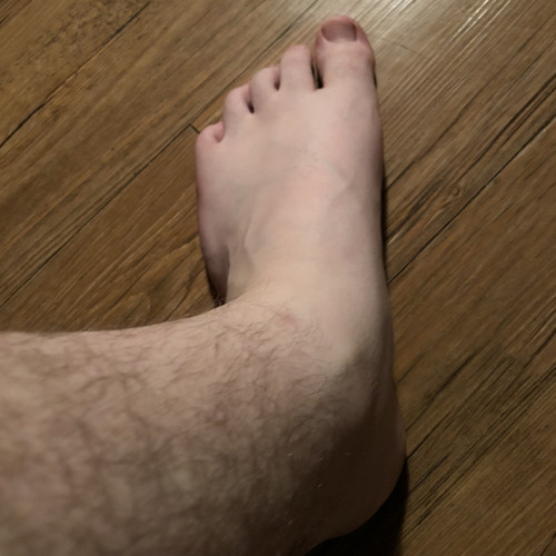 Suck My Heel