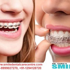 Orthodontic Dental Clinic - Best Dental Clinic in Faridabad