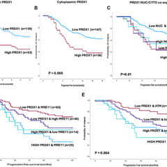 Blocking PRDX1 Protein May Improve Chemotherapy Response in Ovarian Cancer