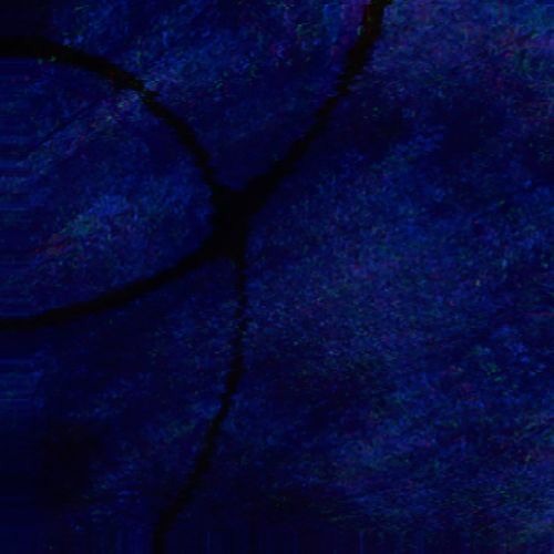 Dead Man (Prod. CRCL)