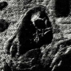 nott.shxm - Nightmare