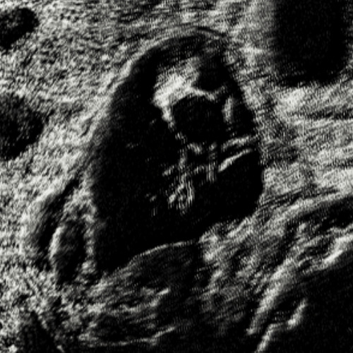 nott.shxm - Nightmare